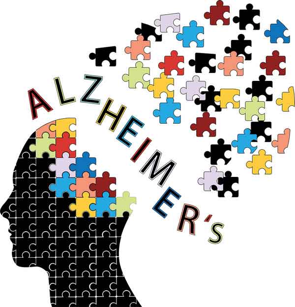 What Is Alzheimers?